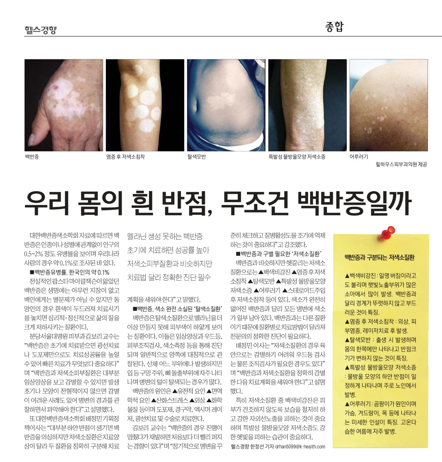 힐하우스 저색소증 감별 사례, 언론보도 관련 사진 1