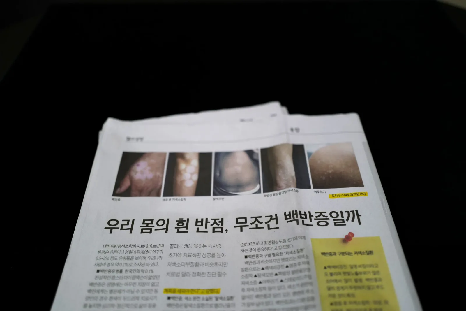 힐하우스 저색소증 감별 사례, 언론보도 대표 이미지