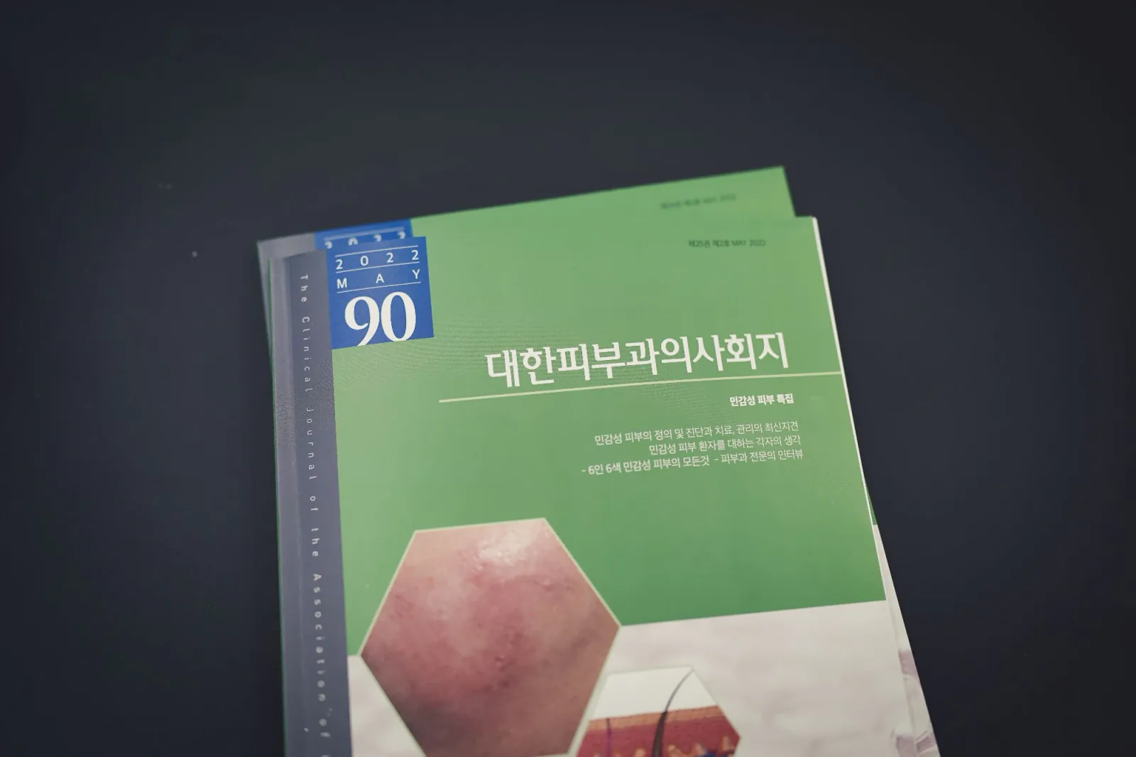 강현진원장님 대한피부과의사회지 기고 대표 이미지