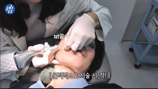 쥬브젠, 부위·깊이별 가격과 상담 전 체크리스트 본문 이미지 2