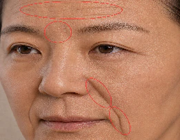 쥬브젠, 부위·깊이별 가격과 상담 전 체크리스트 본문 이미지 6