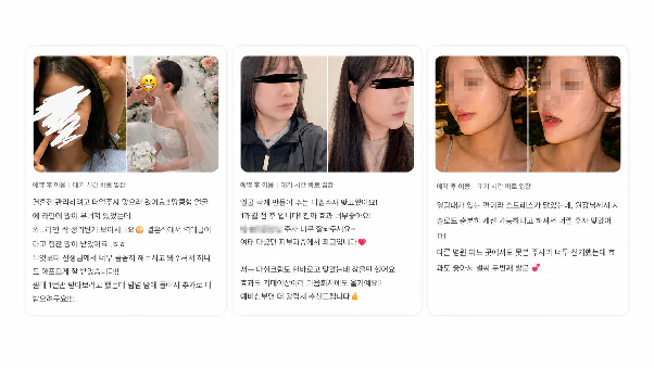 사각턱·넓은하관 때문에 얼굴이 커 보인다면? 윤곽을 정리하는 더엘주사 완전 가이드 본문 이미지 8