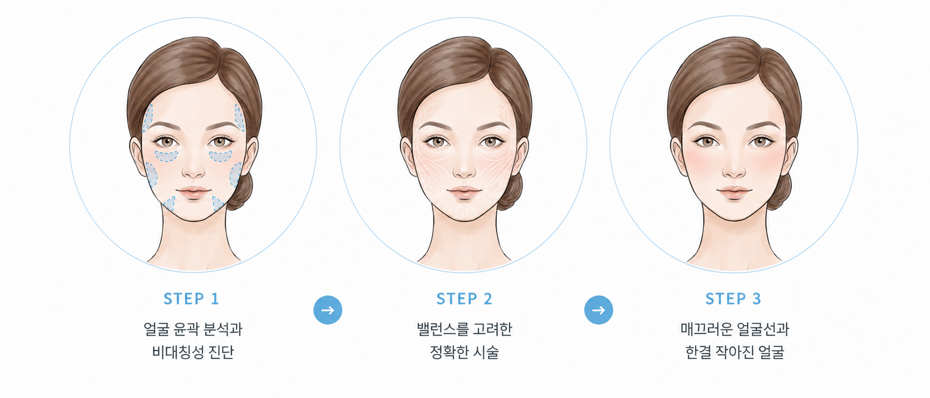 더엘주사로 넓어진 얼굴 라인을 자연스럽게 줄여줍니다.