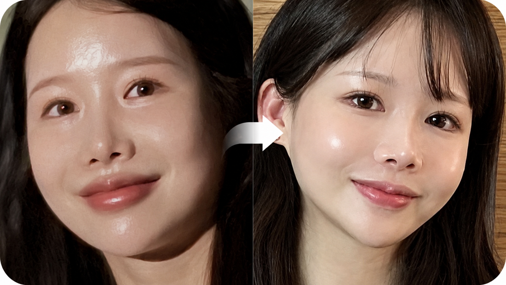 수술 없이 설계하는 프리미엄 윤곽 관리, 더엘주사를 선택해야 하는 이유 본문 이미지 18