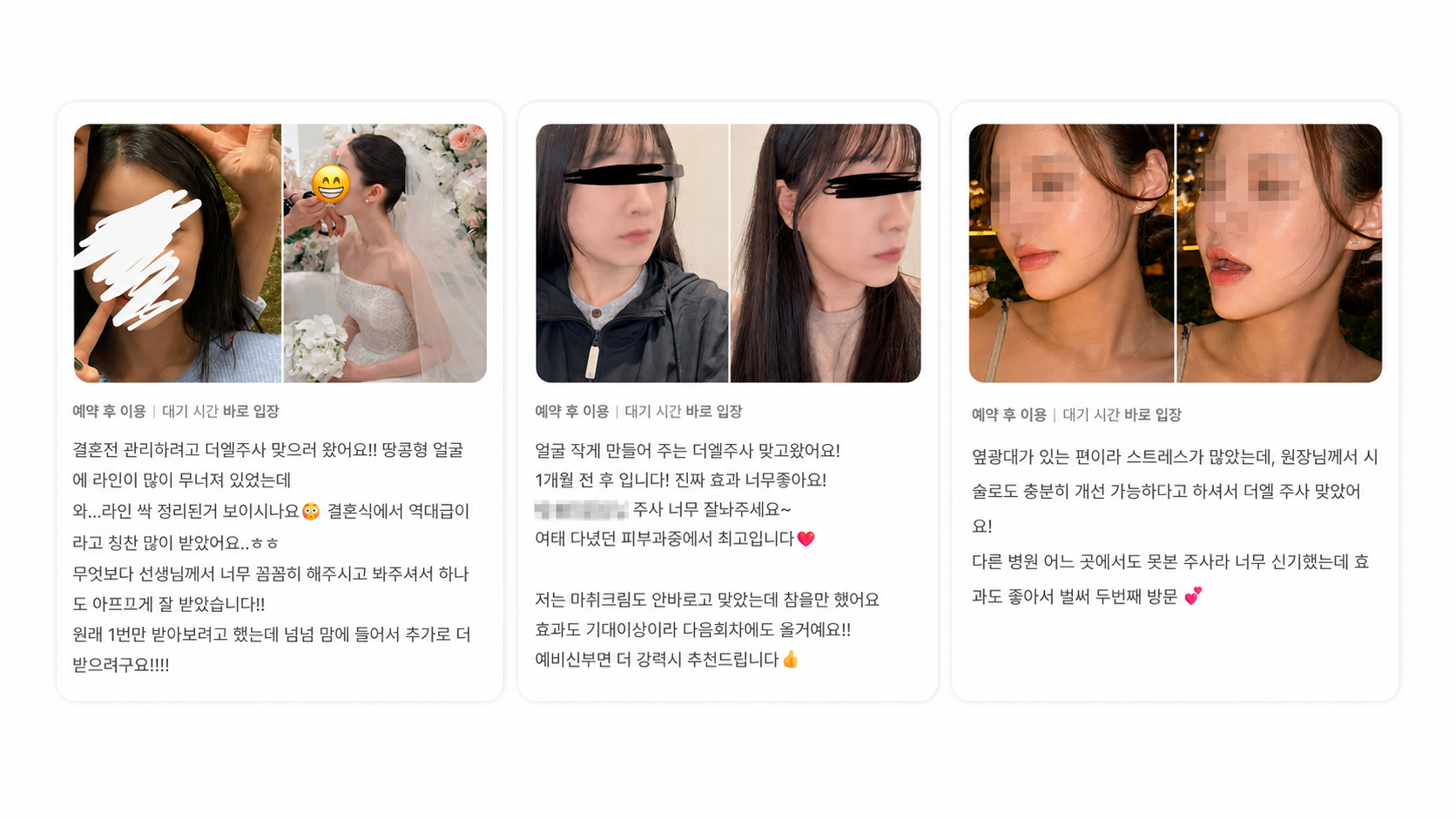 작은 얼굴을 위한 더엘주사, 만족도를 높이는 상담 전 체크리스트 본문 이미지 12