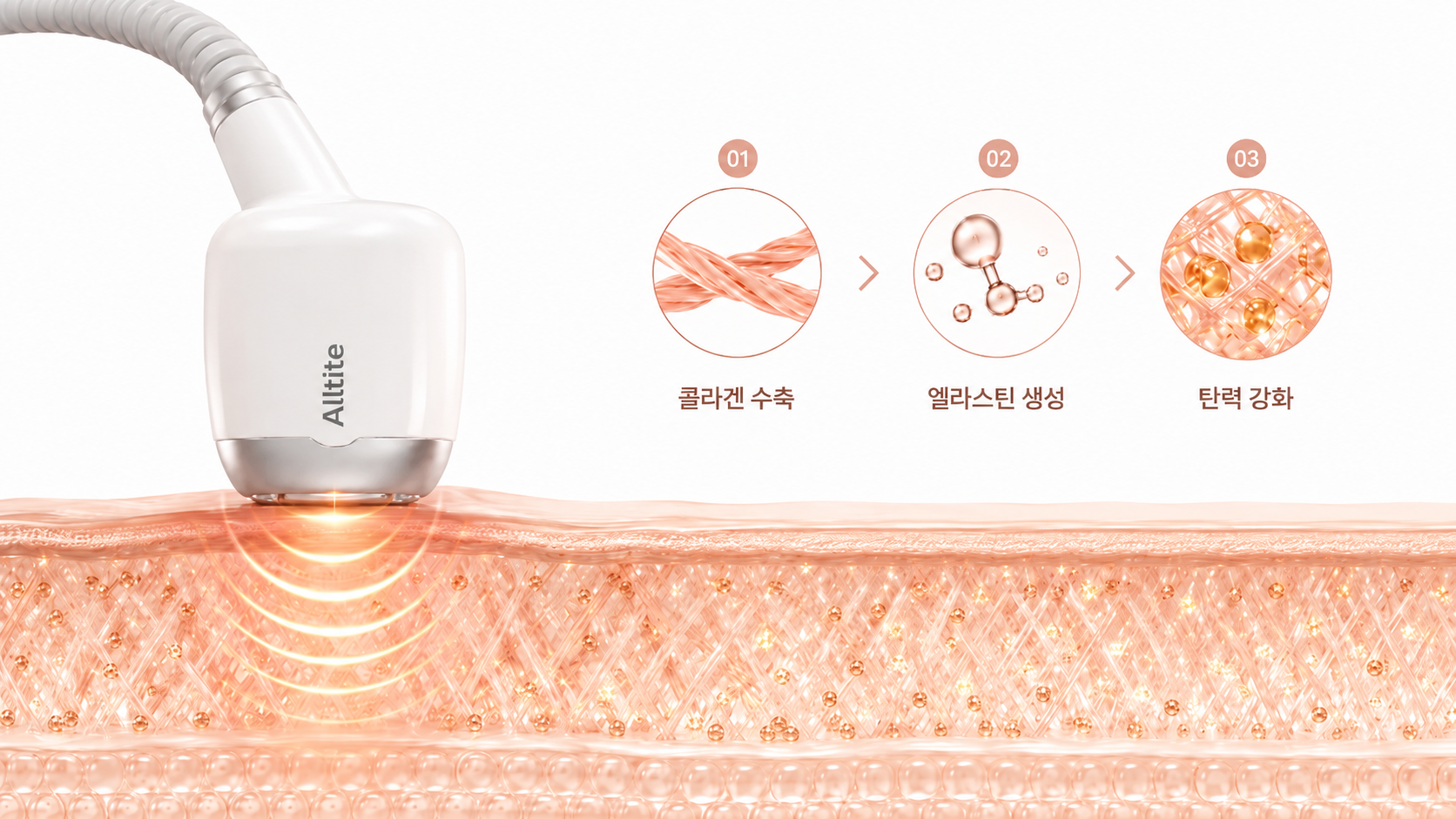 힐하우스피부과 강남점 올타이트, 올타이트만의 DLTD 방법