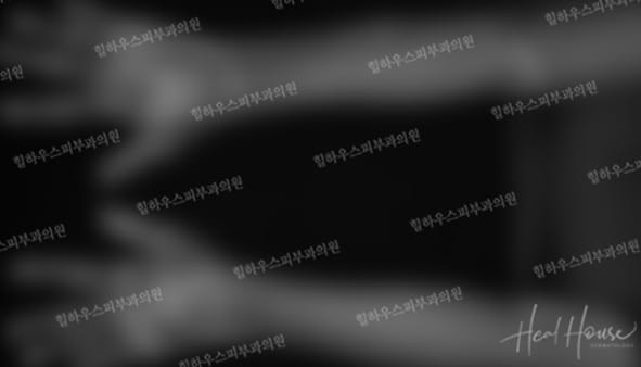 광선치료 후 2